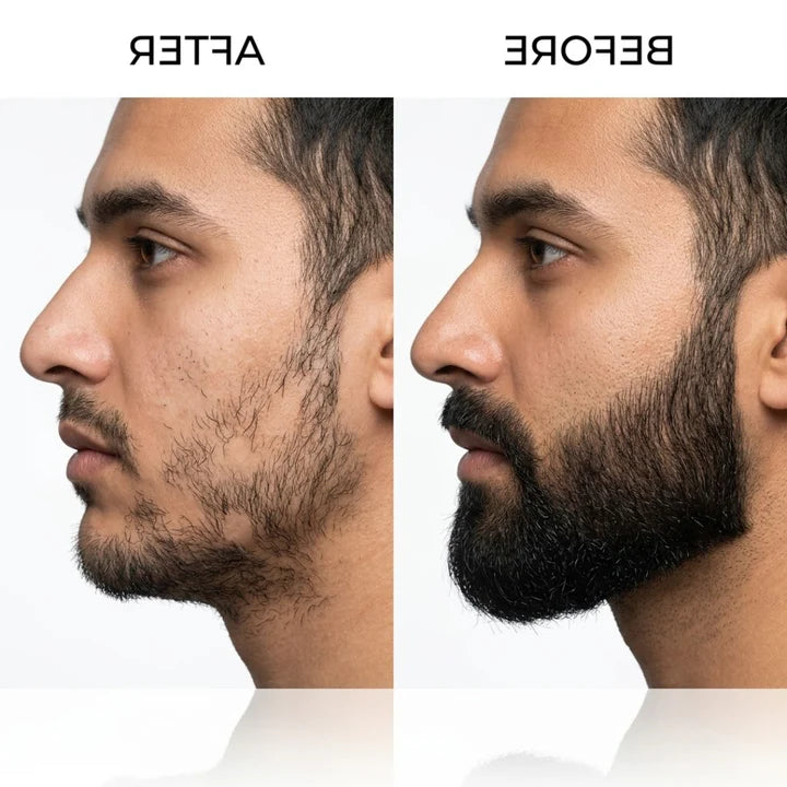 Dr. Alies Professional Beard Growth Oil | Fill Patchy Beard, Stop Itching & Dandruff – Natural 30ml