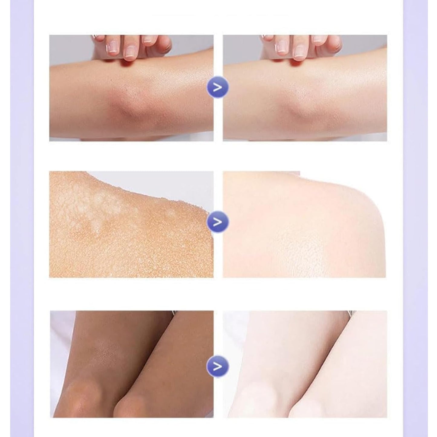 Omenfee Cold White Skin All Over